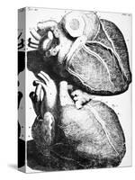 Heart Anatomy, 18th Century-Science Photo Library-Stretched Canvas