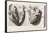 Heart Anatomy, Illustration, 1739-Science Source-Framed Stretched Canvas