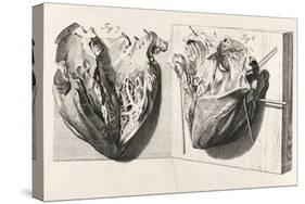 Heart Anatomy, Illustration, 1739-Science Source-Stretched Canvas