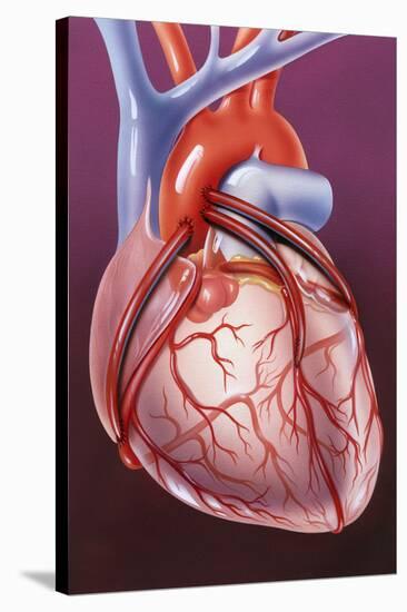 Heart Bypass Grafts-John Bavosi-Stretched Canvas