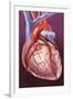 Heart Bypass Grafts-John Bavosi-Framed Photographic Print