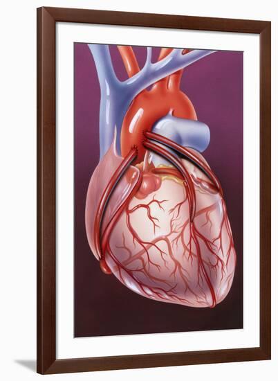 Heart Bypass Grafts-John Bavosi-Framed Photographic Print