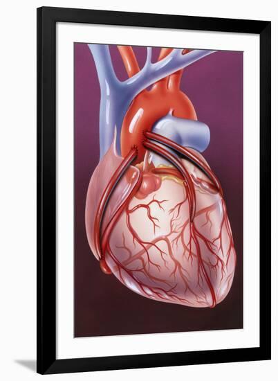 Heart Bypass Grafts-John Bavosi-Framed Photographic Print