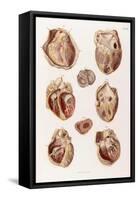 Heart, Cavities and Valves, Illustration, 1878-Science Source-Framed Stretched Canvas