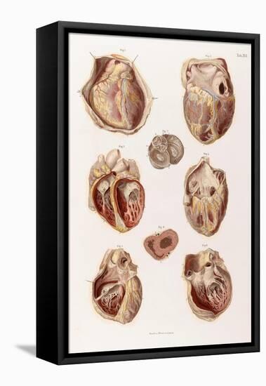 Heart, Cavities and Valves, Illustration, 1878-Science Source-Framed Stretched Canvas