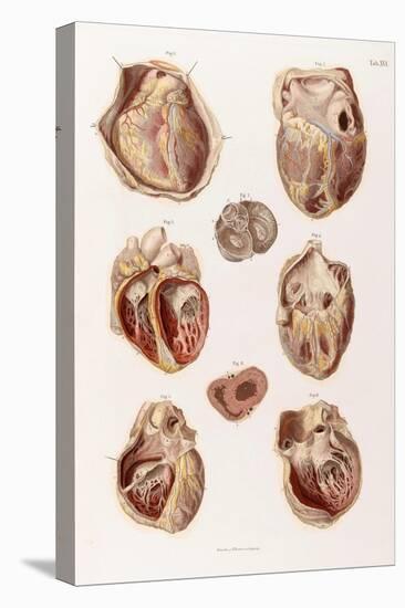 Heart, Cavities and Valves, Illustration, 1878-Science Source-Stretched Canvas