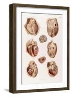 Heart, Cavities and Valves, Illustration, 1878-Science Source-Framed Giclee Print