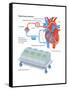Heart-Lung Machine-Encyclopaedia Britannica-Framed Stretched Canvas