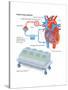 Heart-Lung Machine-Encyclopaedia Britannica-Stretched Canvas