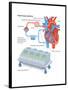 Heart-Lung Machine-Encyclopaedia Britannica-Framed Poster