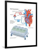 Heart-Lung Machine-Encyclopaedia Britannica-Framed Poster