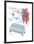Heart-Lung Machine-Encyclopaedia Britannica-Framed Poster