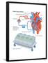 Heart-Lung Machine-Encyclopaedia Britannica-Framed Poster