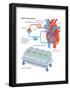 Heart-Lung Machine-Encyclopaedia Britannica-Framed Poster