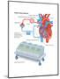 Heart-Lung Machine-Encyclopaedia Britannica-Mounted Poster