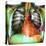 Heart Pacemaker, X-ray-Du Cane Medical-Stretched Canvas
