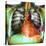 Heart Pacemaker, X-ray-Du Cane Medical-Stretched Canvas