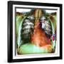 Heart Pacemaker, X-ray-Du Cane Medical-Framed Photographic Print