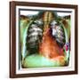 Heart Pacemaker, X-ray-Du Cane Medical-Framed Photographic Print