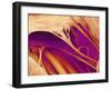 Heart Valve And Strings, SEM-Susumu Nishinaga-Framed Photographic Print