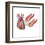Heart with Arteries Showing Cholesterol in One and Plaque in the Other-null-Framed Art Print