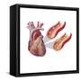 Heart with Arteries Showing Cholesterol in One and Plaque in the Other-null-Framed Stretched Canvas