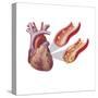 Heart with Arteries Showing Cholesterol in One and Plaque in the Other-null-Stretched Canvas