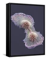 HeLa Cell Division, SEM-Thomas Deerinck-Framed Stretched Canvas