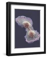 HeLa Cell Division, SEM-Thomas Deerinck-Framed Premium Photographic Print