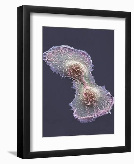 HeLa Cell Division, SEM-Thomas Deerinck-Framed Premium Photographic Print