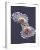 HeLa Cell Division, SEM-Thomas Deerinck-Framed Photographic Print