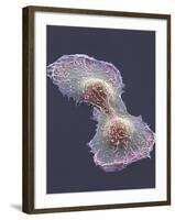 HeLa Cell Division, SEM-Thomas Deerinck-Framed Photographic Print