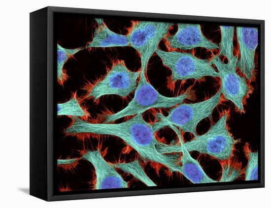 HeLa Cells, Light Micrograph-Thomas Deerinck-Framed Stretched Canvas