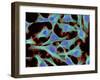 HeLa Cells, Light Micrograph-Thomas Deerinck-Framed Photographic Print