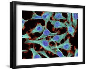 HeLa Cells, Light Micrograph-Thomas Deerinck-Framed Photographic Print