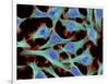 HeLa Cells, Light Micrograph-Thomas Deerinck-Framed Photographic Print