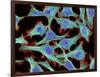 HeLa Cells, Light Micrograph-Thomas Deerinck-Framed Photographic Print