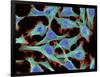 HeLa Cells, Light Micrograph-Thomas Deerinck-Framed Photographic Print