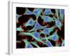 HeLa Cells, Light Micrograph-Thomas Deerinck-Framed Photographic Print