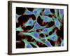 HeLa Cells, Light Micrograph-Thomas Deerinck-Framed Photographic Print