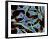 HeLa Cells, Light Micrograph-Thomas Deerinck-Framed Photographic Print