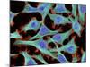 HeLa Cells, Light Micrograph-Thomas Deerinck-Mounted Photographic Print