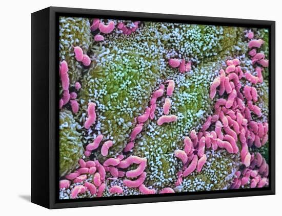 Helicobacter Pylori Bacteria In Stomach-null-Framed Stretched Canvas