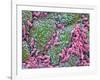 Helicobacter Pylori Bacteria In Stomach-null-Framed Photographic Print