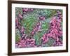 Helicobacter Pylori Bacteria In Stomach-null-Framed Photographic Print