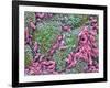 Helicobacter Pylori Bacteria In Stomach-null-Framed Photographic Print