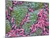Helicobacter Pylori Bacteria In Stomach-null-Mounted Photographic Print