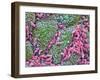 Helicobacter Pylori Bacteria In Stomach-null-Framed Photographic Print