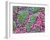 Helicobacter Pylori Bacteria In Stomach-null-Framed Photographic Print