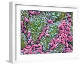 Helicobacter Pylori Bacteria In Stomach-null-Framed Photographic Print